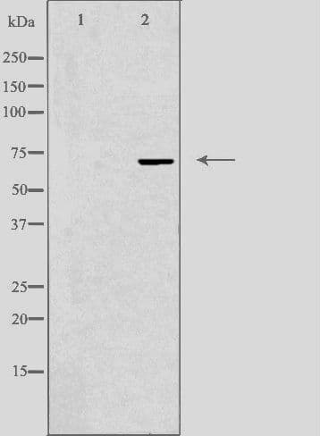 FZD8 / Frizzled 8 Antibody