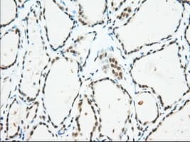 USP5 Antibody (clone OTI2E3)