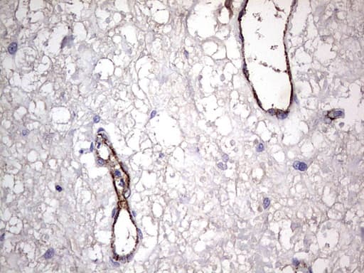 VWF / Von Willebrand Factor Antibody (aa764-1263, clone OTI6C7)