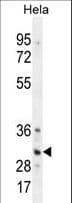TRADD Antibody (aa126-151)