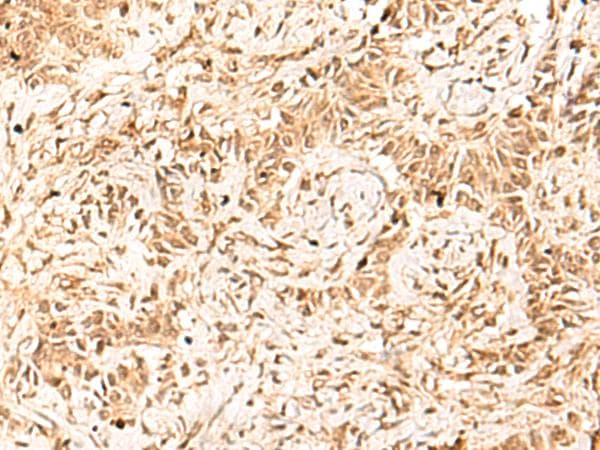 Polyclonal Rabbit anti-Human HNF4A / HNF4 Antibody (IHC)