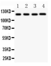 NALP3 / NLRP3 Antibody (aa21-194)