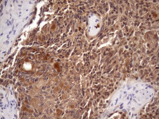 Vps60 / CHMP5 Antibody (clone OTI5C7)