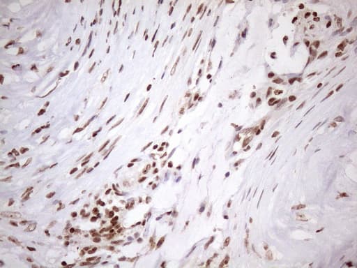EXOSC1 / CSL4 Antibody (clone OTI4B7)