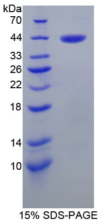 Human SERPINB6 / PI-6 Protein (Recombinant His-T7)