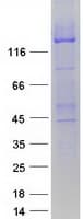 Human ABCC8 / SUR1 Protein (Recombinant Myc-DDK (Flag))