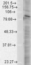 IHC-plus™ HIF2A / EPAS1 Antibody (clone EP190b)