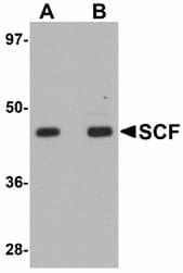 IHC-plus™ Polyclonal Rabbit anti-Human KITLG / SCF Antibody (IHC, IF, WB)