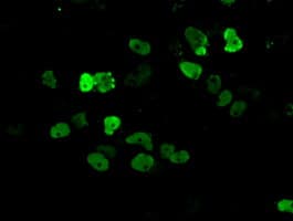 ARNT / HIF-1-Beta Antibody (clone OTI1A1)