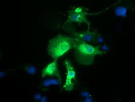 Monoclonal Mouse anti-Human PTPRE / PTP Epsilon Antibody (clone OTI2A9, IHC, IF)