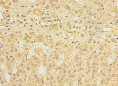 DIS3L Antibody