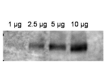 IHC-plus™ ABCB1 / MDR1 / P Glycoprotein Antibody