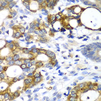 Polyclonal Rabbit anti-Human AMY2A / Pancreatic Amylase Antibody (IHC, WB)