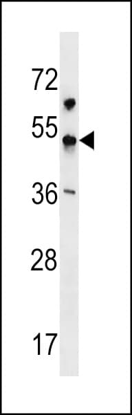 KCNJ18 Antibody (aa94-122)