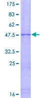 Human TIMP3 Protein (Recombinant GST)