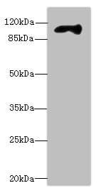 Polyclonal Rabbit anti-Human MBTPS1 / S1P Antibody (IHC, WB)