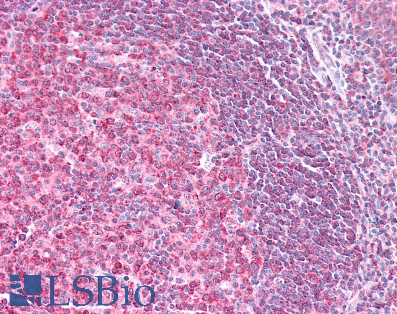 IHC-plus™ LIMS1 / PINCH Antibody