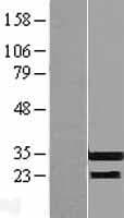 RFPL3 Protein (Over-Expression Lysate Myc-DDK (Flag))