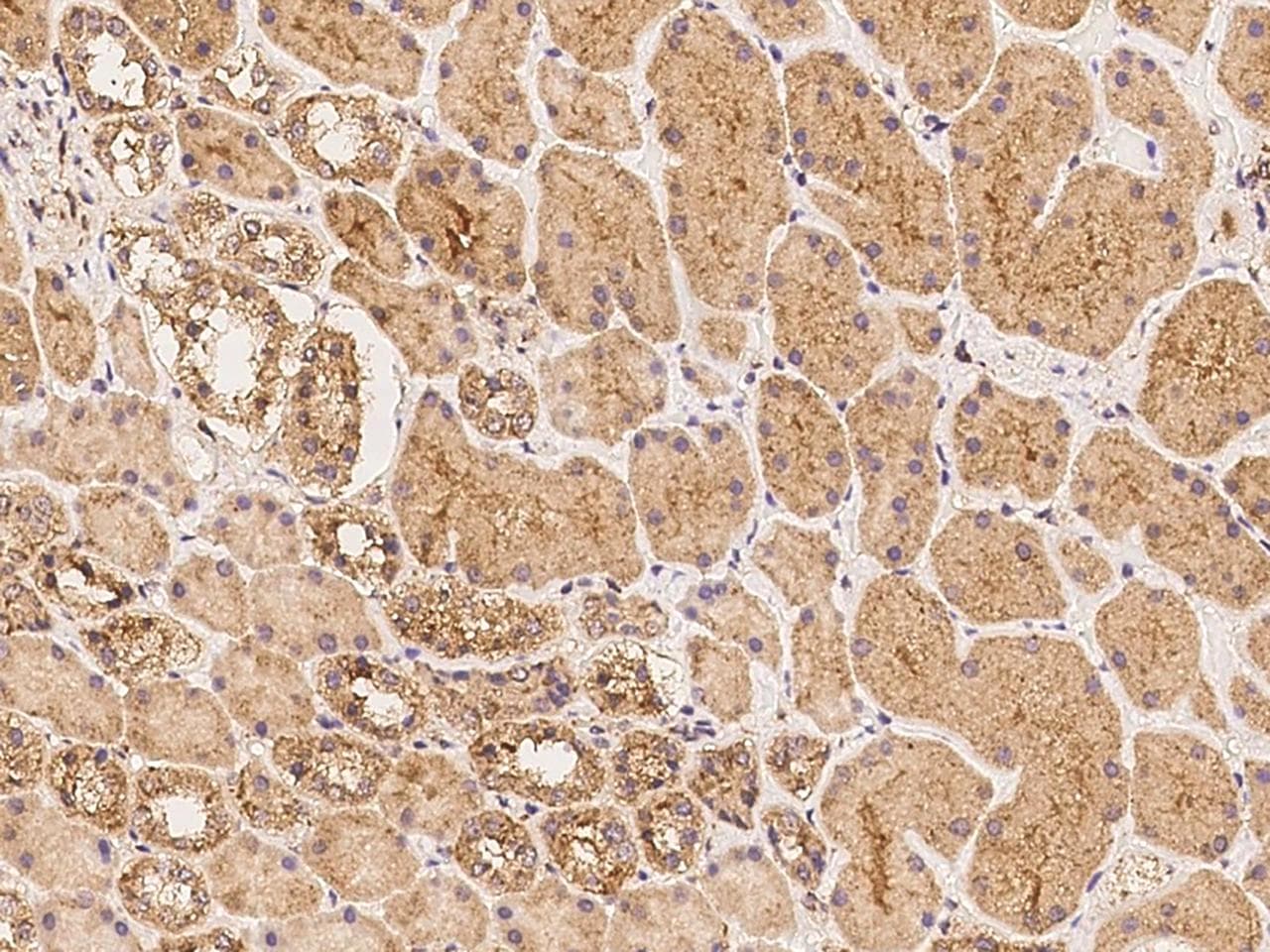 TMEM194A Antibody