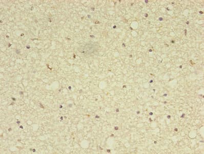 ADAMTS7 Antibody