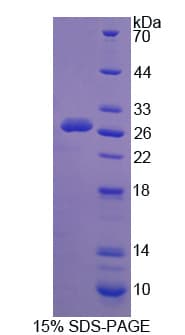 Human CAPN3 / Calpain 3 Protein (Recombinant His)