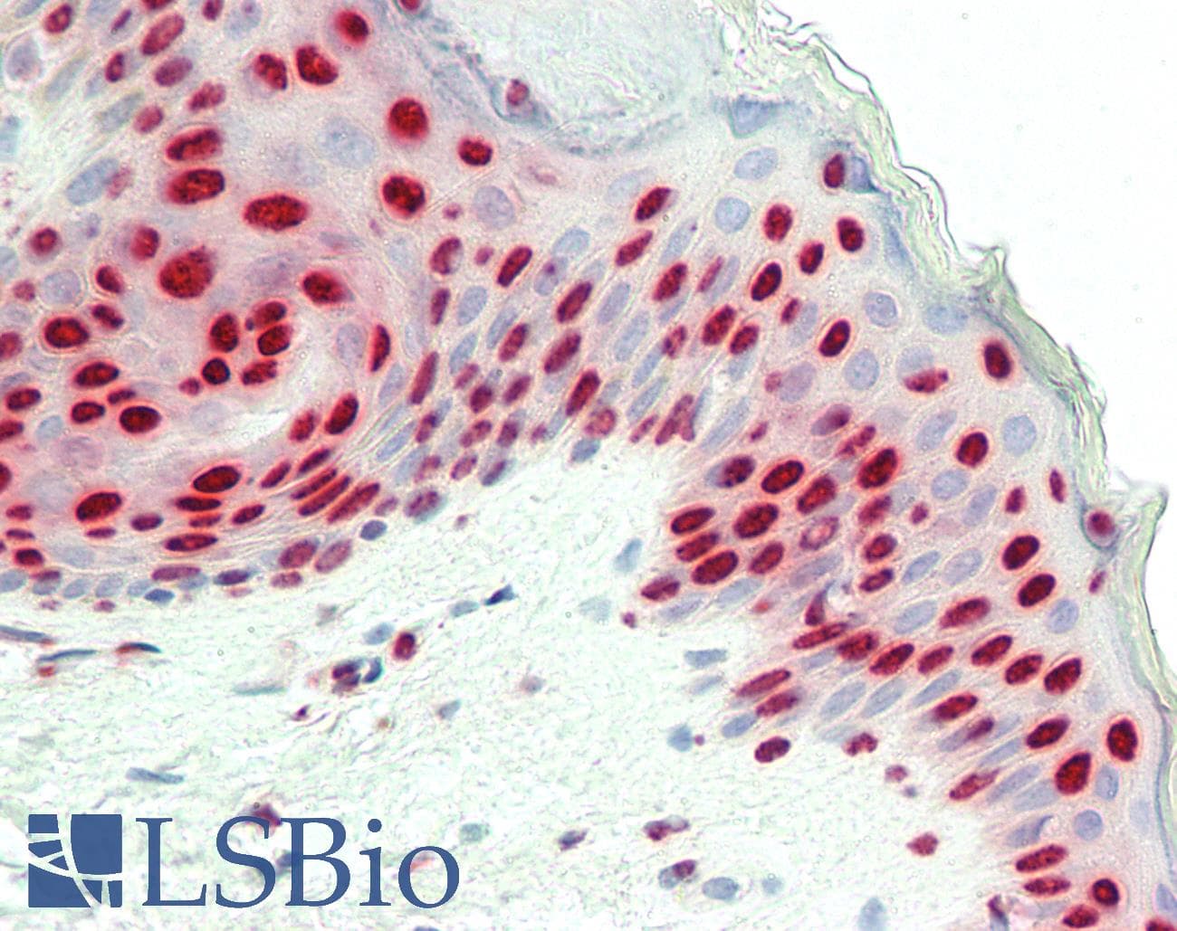 IHC-plus™ Polyclonal Rabbit anti-Human MATR3 / Matrin 3 Antibody (aa800-C-term, IHC, IF, WB)