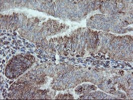 NDUFB10 Antibody (clone OTI1H6)