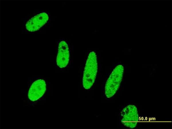 BIRC5 / Survivin Antibody (clone 5B10)
