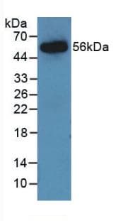 AGT / Angiotensinogen Antibody (aa25-477)