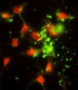 SRP72 Antibody (aa119-148)