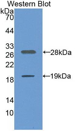 SIRT1 / Sirtuin 1 Antibody (aa244-498, clone C4, PE)