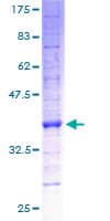 Human ATP5G1 / ATP5G Protein (Recombinant GST)