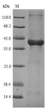 Mouse GAL4 / Galectin 4 Protein (Recombinant 6His, N-terminus)