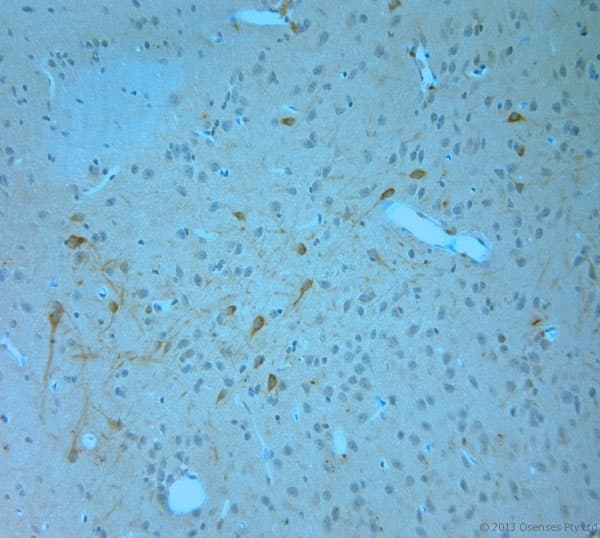 Polyclonal Rabbit anti-Human ITPR1 / IP3 Receptor Type 1 Antibody (aa700-750, IHC)