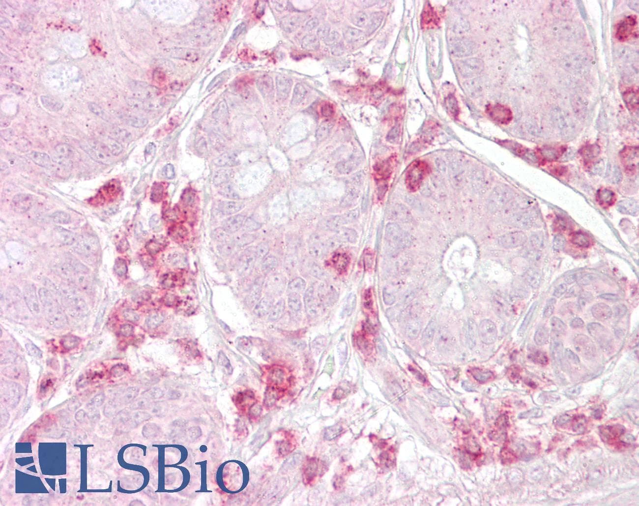 Polyclonal Rabbit anti-Human METAP2 Antibody (aa95-144, IHC, WB)