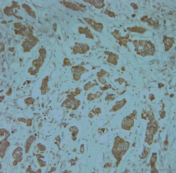 KCNJ13 / KIR7.1 Antibody (aa2-50)