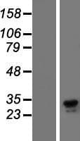 CLEC7A / Dectin 1 Protein (Over-Expression Lysate Myc-DDK (Flag))