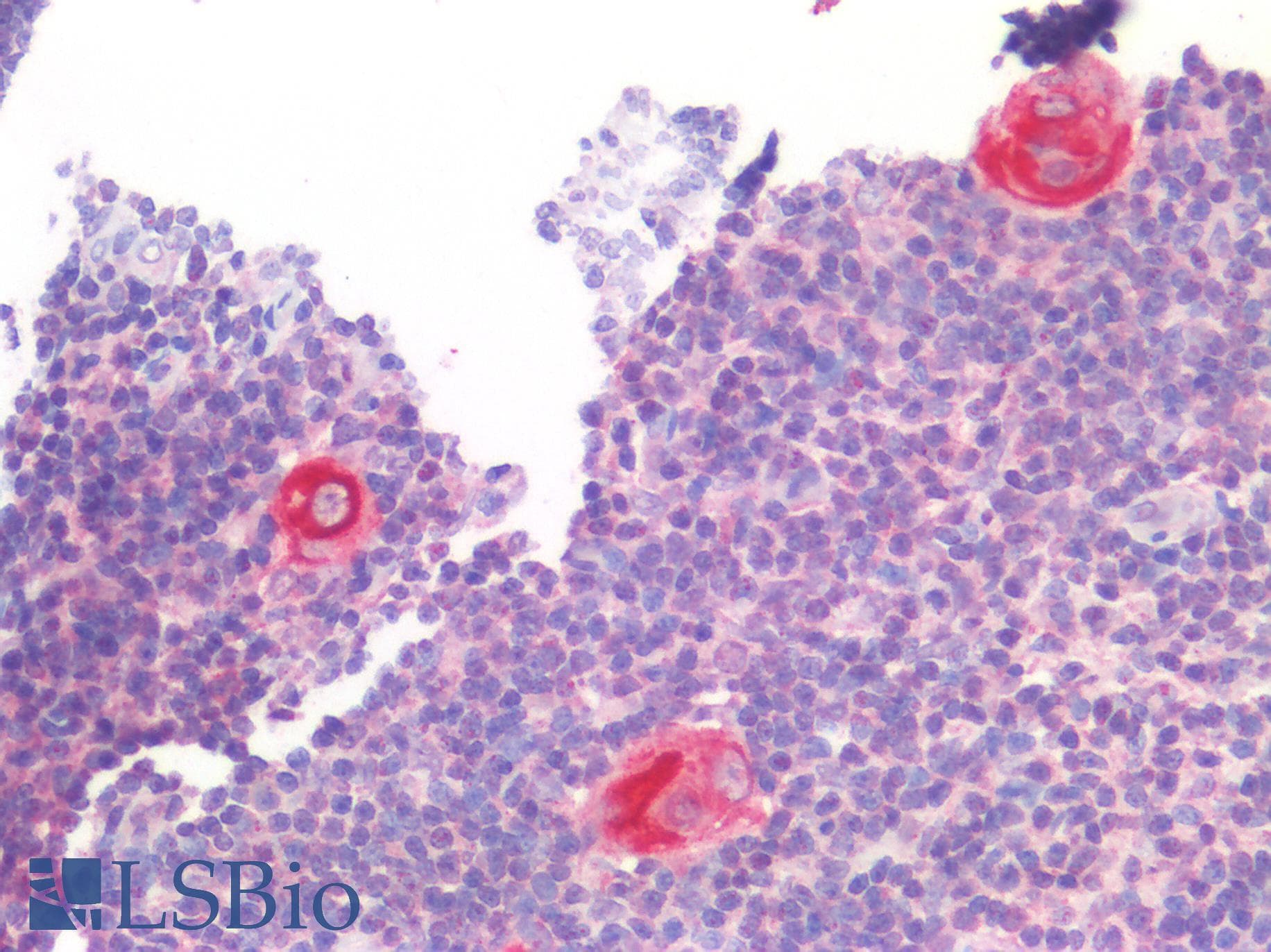 IHC-plus™ Polyclonal Rabbit anti-Human ITGAM / CD11b Antibody (IHC)