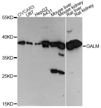 Polyclonal Rabbit anti-Human GALM / Mutarotase Antibody (WB)