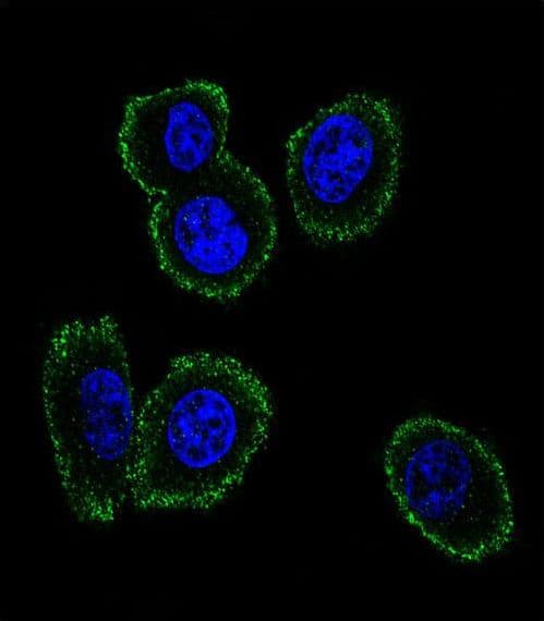 NMB / Neuromedin B Antibody (aa15-42)