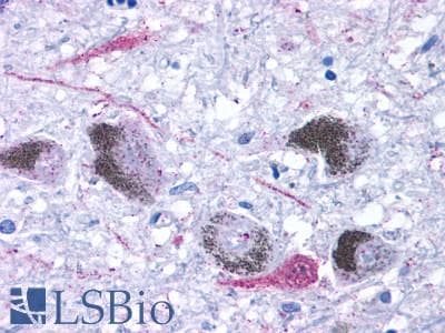 PathPlus™ TAAR9 Antibody (Extracellular Domain)