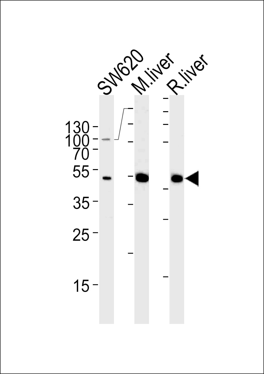 OTC Antibody (aa71-98)