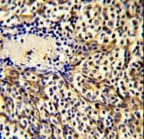 Polyclonal Rabbit anti-Human CCL3 / MIP-1-Alpha Antibody (aa59-87, IHC, WB)