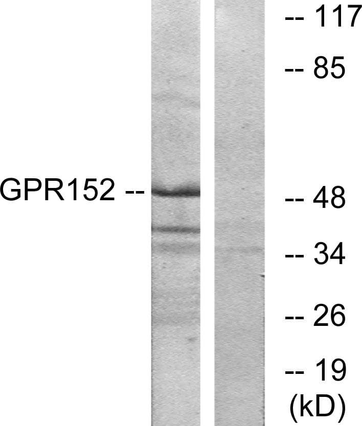 Polyclonal Rabbit anti-Human GPR152 Antibody (WB)