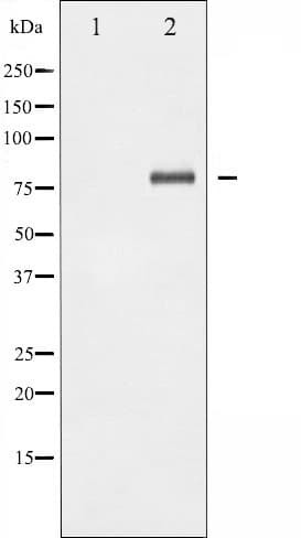 Polyclonal Rabbit anti-Human RELA / NFKB p65 Antibody (Acetyl-Lys310, IHC, IF, WB)