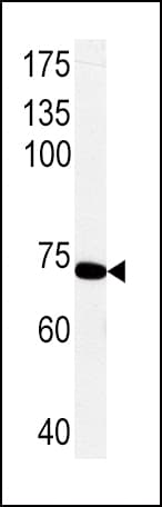 PCK1 Antibody (aa592-622)