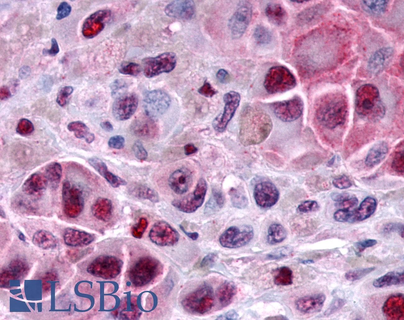 PathPlus™ FAK / Focal Adhesion Kinase Antibody (Internal)