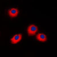 ERAS Antibody (C-Terminus)