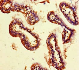 SMYD2 Antibody