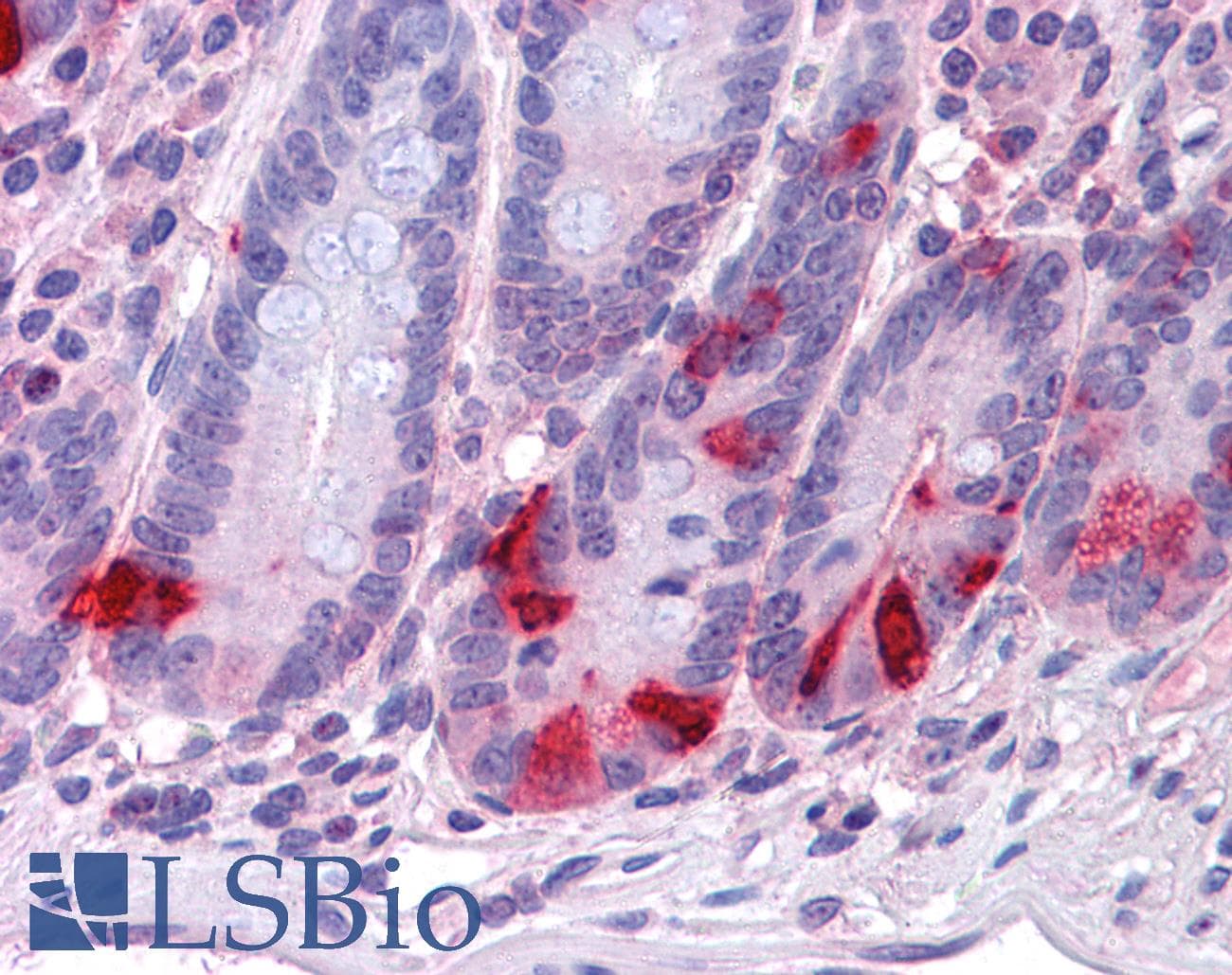 IHC-plus™ Polyclonal Goat anti-Human CHGA / Chromogranin A Antibody (aa85-97, IHC, WB)